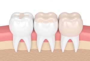 Konya Diş Hekimliği Uygulamaları