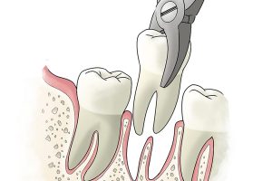 Konya Diş Hekimliği Uygulamaları
